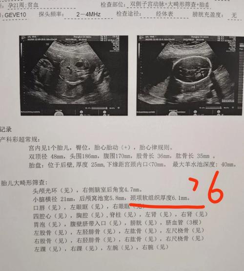 NF宝贝国际生殖中心_NF宝贝国际生殖中心:助您实现生育梦想第三代试管代孕宝宝